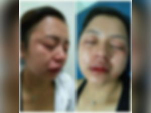 Brutal! Wanita Cantik Ini Dihajar Mantan Suami di Teras Rumah
