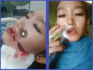 Kecewa Diputusin, Pria di Kapuas Tega Sayat Wajah Mantan Pacarnya