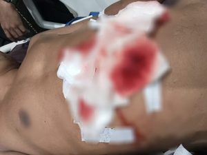 Niat Melerai Perkelahian, Pria di Kapuas Malah Tertusuk Sangkur