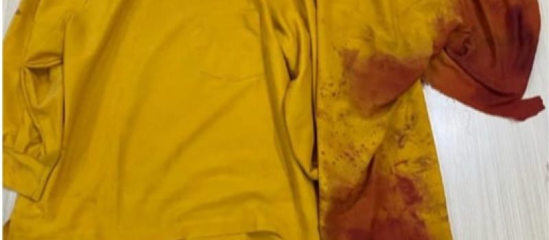 Cekcok Rumah Tangga di Tanbu,  Istri Bersimbah Darah