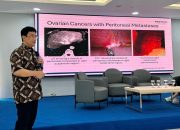 HIPEC Hadir di Primaya Kelapa Gading, Terapi Kanker Lanjut Kini Tanpa ke Luar Negeri