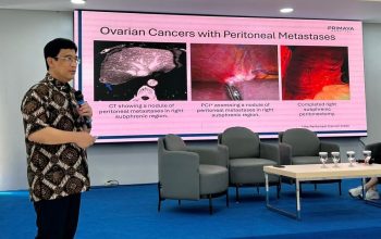 HIPEC Hadir di Primaya Kelapa Gading, Terapi Kanker Lanjut Kini Tanpa ke Luar Negeri