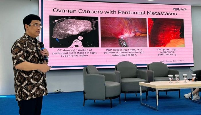 HIPEC Hadir di Primaya Kelapa Gading, Terapi Kanker Lanjut Kini Tanpa ke Luar Negeri