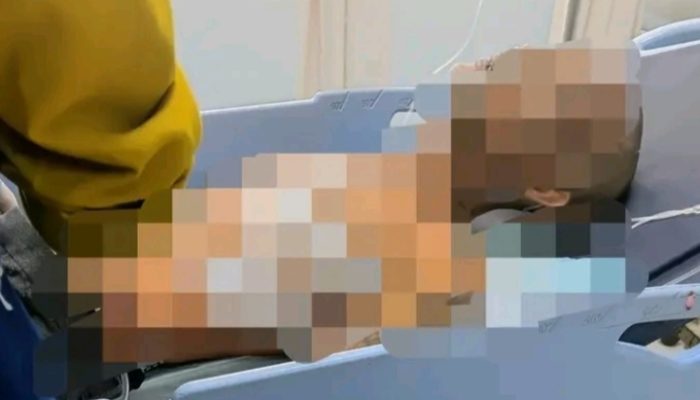 Perkelahian Berdarah di Pasar Tanjung Tabalong, Satu Pria Terluka Kena Sajam