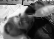 Perempuan terbaring di tempat tidur rumah sakit, luka di wajah terlihat