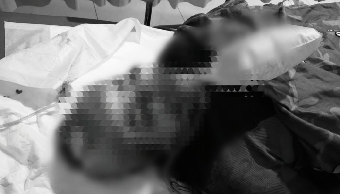 Seorang Perempuan Luka Serius di Kompleks Kijang Mas, Polisi Selidiki Penyebabnya