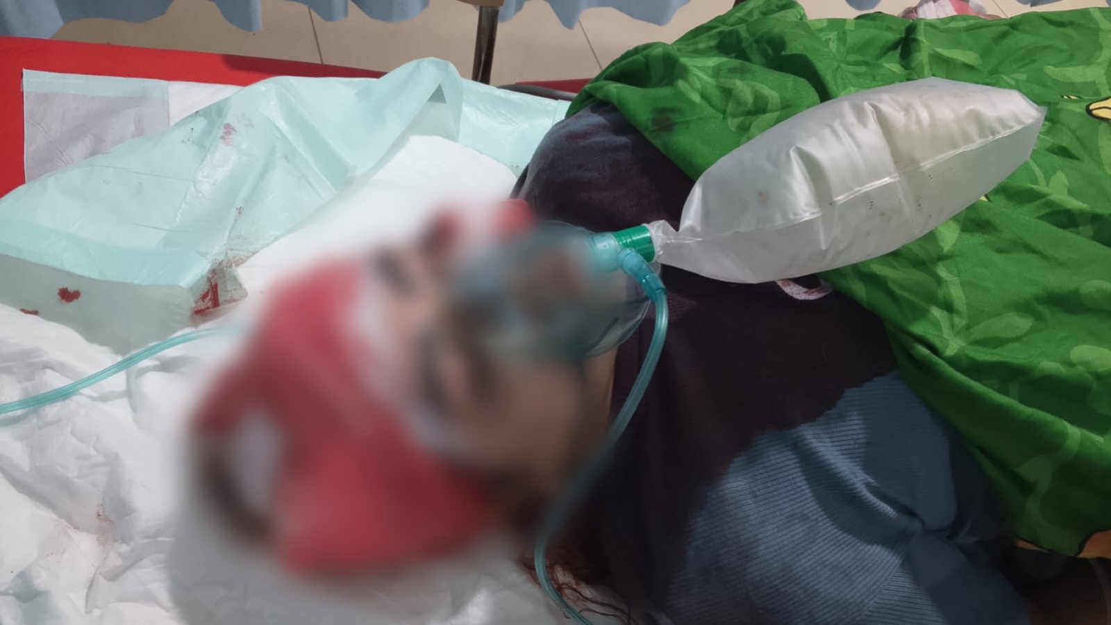 Perempuan terbaring di tempat tidur rumah sakit, petugas medis di sampingnya
